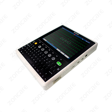 BY_NOSSOS EQUIPAMENTOS_ECG_3